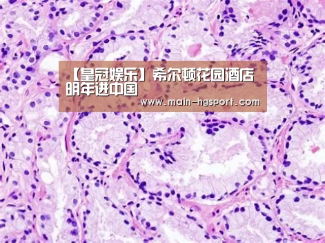 皇冠体育